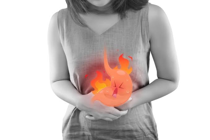 Acidity / Acid Reflux : How to Manage And Avoid